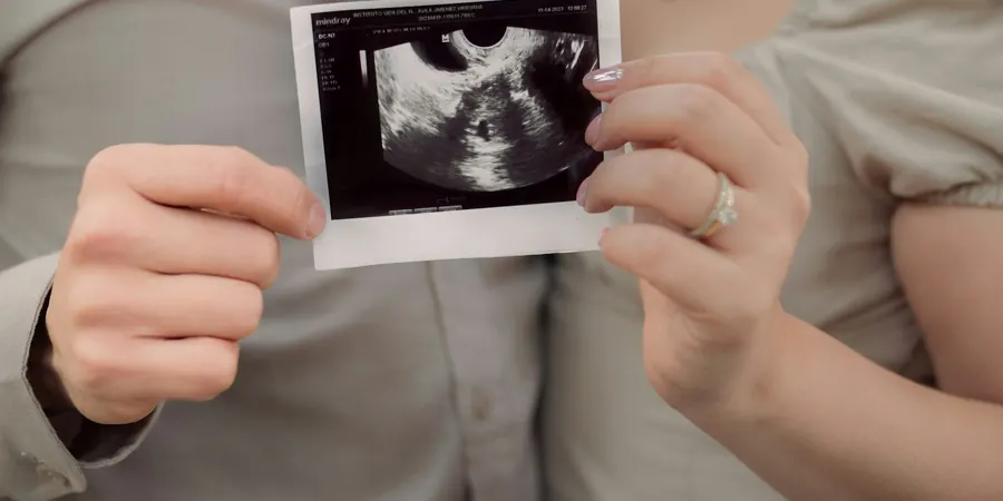 Casal segurando a imagem de um ultrassom da gestação depois de um ecocardiograma fetal alterado