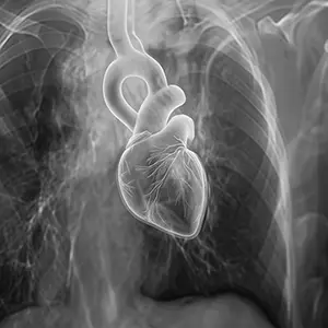 img-cardiopatias-congenitas-alberth-tavares-cardiologista-pediatrico-brasilia-df